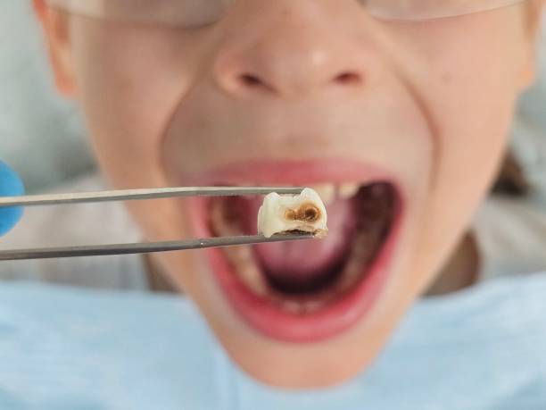 Best Emergency Dental Care for Abscessed Tooth in Dixon, IL