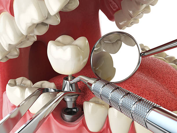 Best Emergency Dentist for Special Needs Patients in Dixon, IL